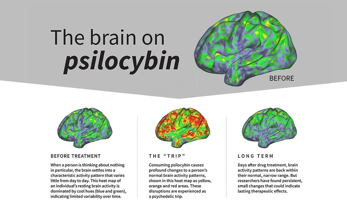 the brain on psilocybin
